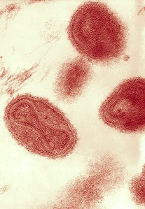 Smallpox virus varions